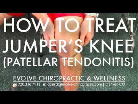 Easy Treatment for Jumper's Knee (Patellar Tendonitis) - Denver Sports Chiropractor