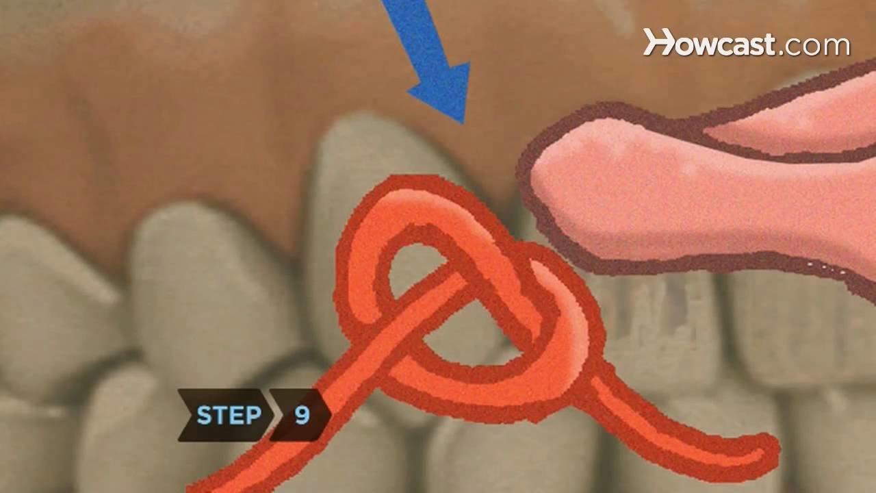 Knot Compilation