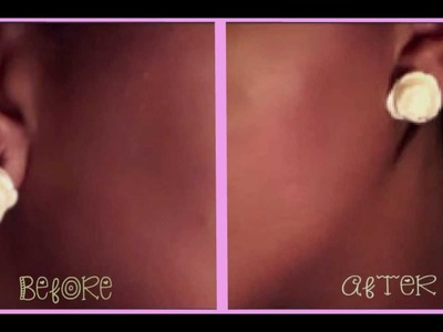 DIY How to Temporarily Close Your Gauges. Stretched Ears Tutorial