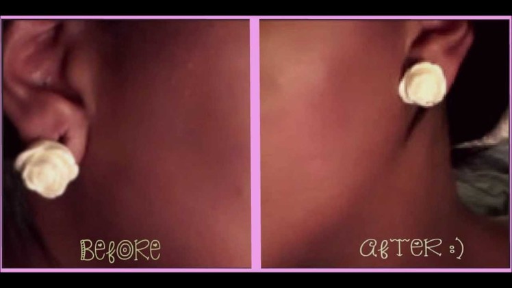 DIY How to Temporarily Close Your Gauges. Stretched Ears Tutorial