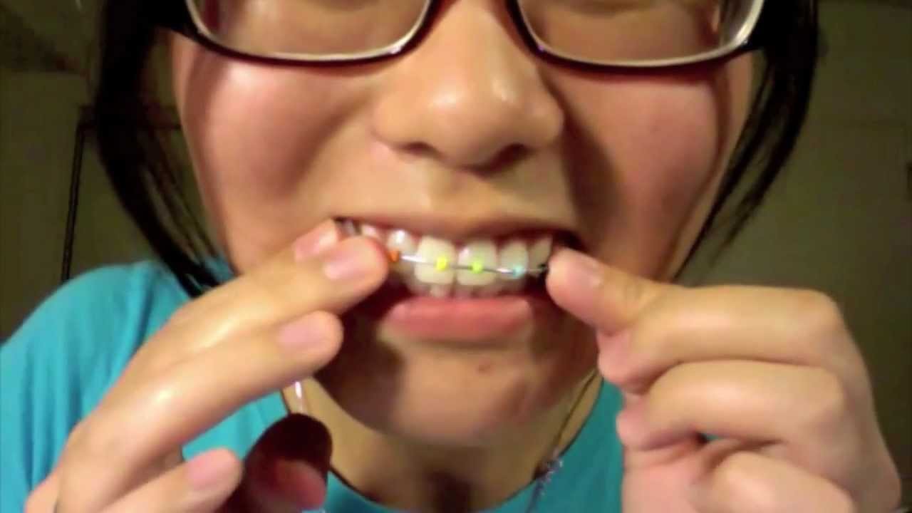 Tutorial: How to Make Fake Braces that Look Real!