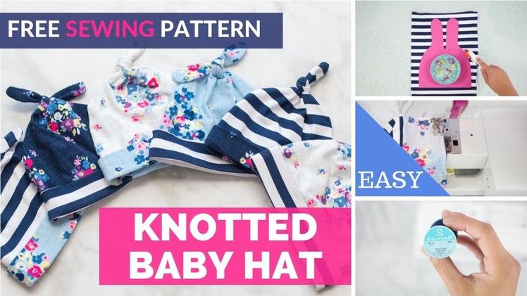 Every Baby Needs an Adorable Baby Hat!