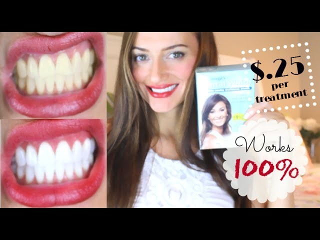 How to get 100% SUPER WHITE TEETH! | Delaney