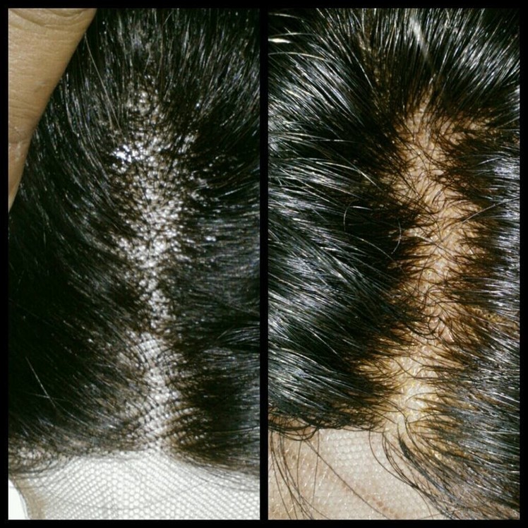 How to: Bleach Knot and Prevent Shedding on Lace closure