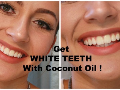 How To WHITEN Your TEETH With Coconut Oil