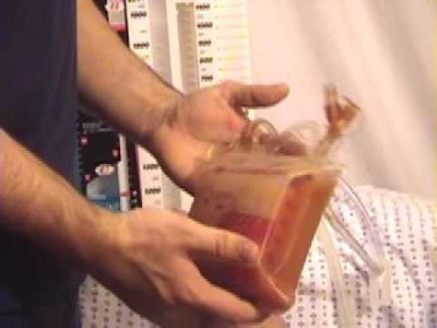 Autotransfusion and you.instructional video