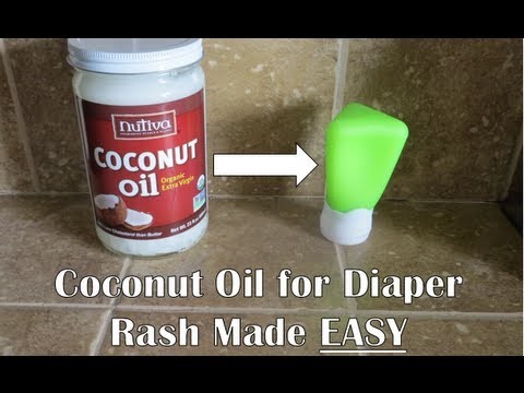 Coconut Oil for diaper rash MADE EASY!