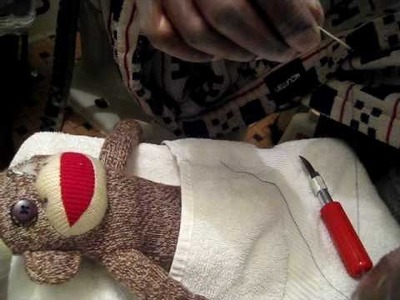 Sock Monkey Surgery restoration of the Button Eyes