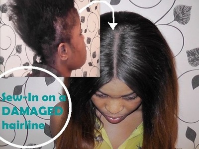Sew-In on DAMAGED hairline - How I do it!