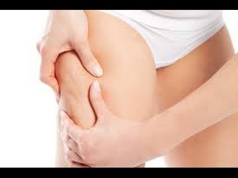 How to remove cellulite