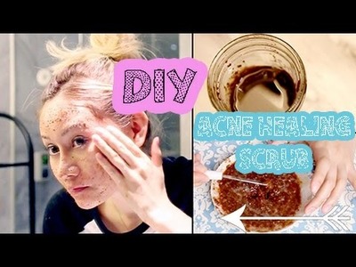 DIY: The BEST Homemade Acne Scrub