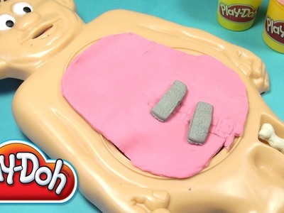 Play-Doh Operation Playset Playdough Operation Hasbro Toy
