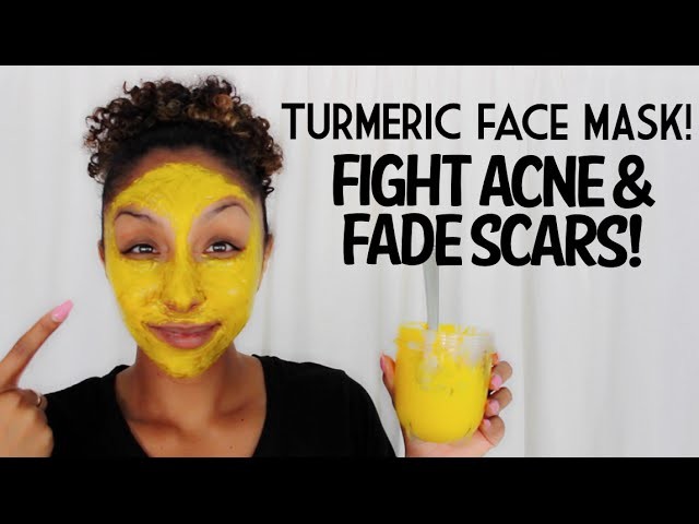 DIY Turmeric Face Mask! Fight Acne and Fade Scars!| BiancaReneeToday