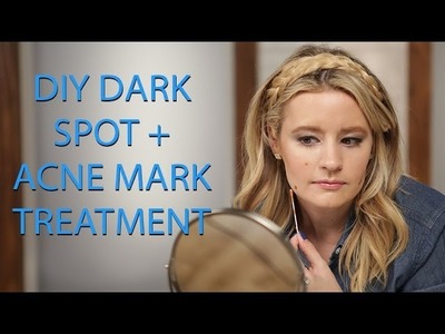 DIY Beauty | Acne Scar Treatment | Beauty How To