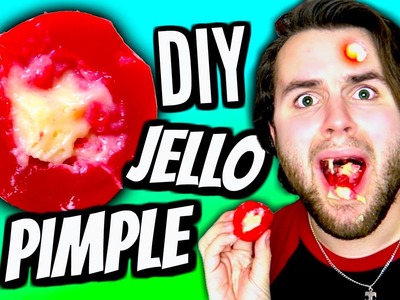 DIY Edible Jello Pimple! | How To Make A Giant Jelly Gummy Zit With Pus Pudding Tutorial!
