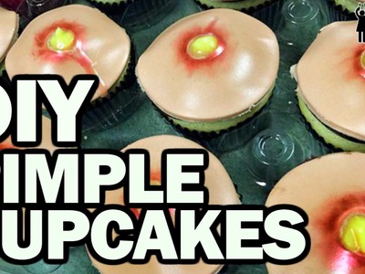 DIY Pimple Cupcakes, Corinne VS Cooking #12