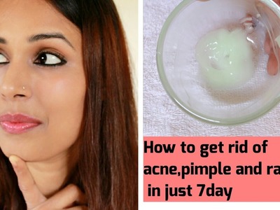 HOW TO get rid of Acne, pimple and Rashes In Just 7 Days.100% natural also remove acne scars & marks