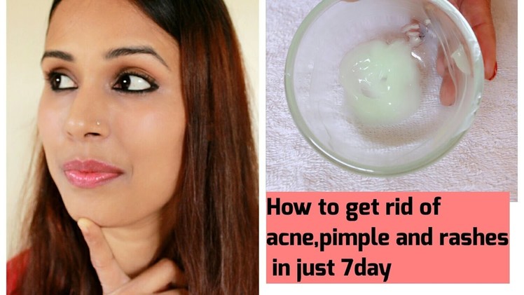 HOW TO get rid of Acne, pimple and Rashes In Just 7 Days.100% natural also remove acne scars & marks