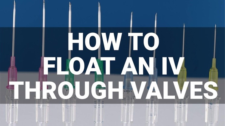 How to Float an IV Through Valves