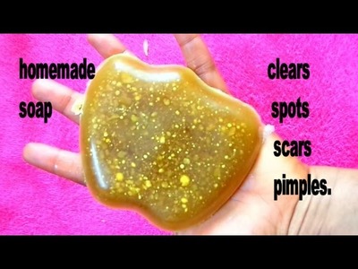 HOME-MADE SOAP CLEAR SPOTS, PIMPLES AND SCARS TREATMENT | HOW TO MAKE SOAP AT HOME