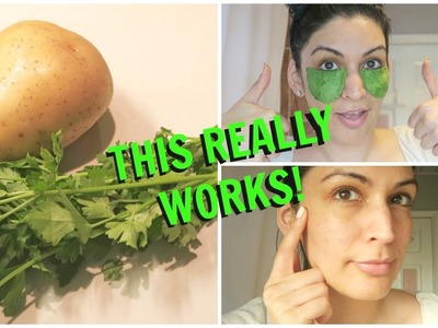 INSTANT RESULTS! DIY Potato & Parsley Mix to Remove Dark Circles, Fine Lines + Wrinkles????