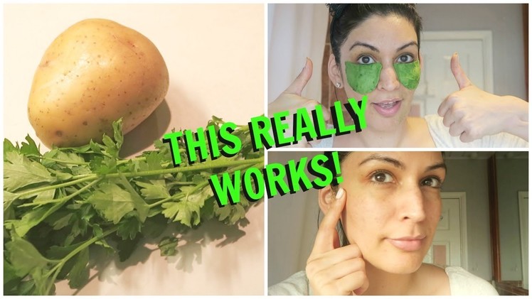INSTANT RESULTS! DIY Potato & Parsley Mix to Remove Dark Circles, Fine Lines + Wrinkles????