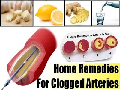 This garlic,ginger and lemon remedy cures clogged arteries - angina