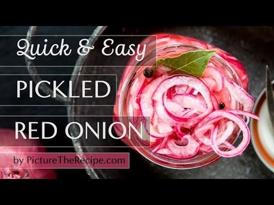 Quick & Easy Pickled Red Onion