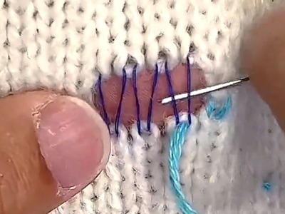 Magic Way to Repair a Hole in a Sweater With a Sewing Needle