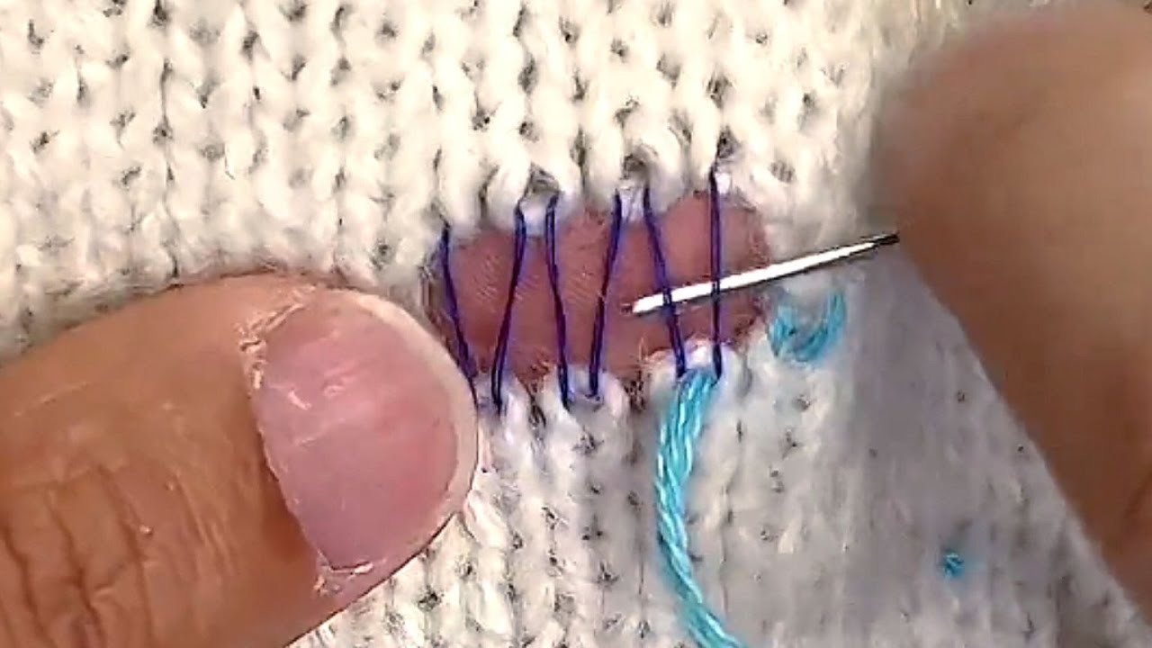 Magic Way to Repair a Hole in a Sweater With a Sewing Needle